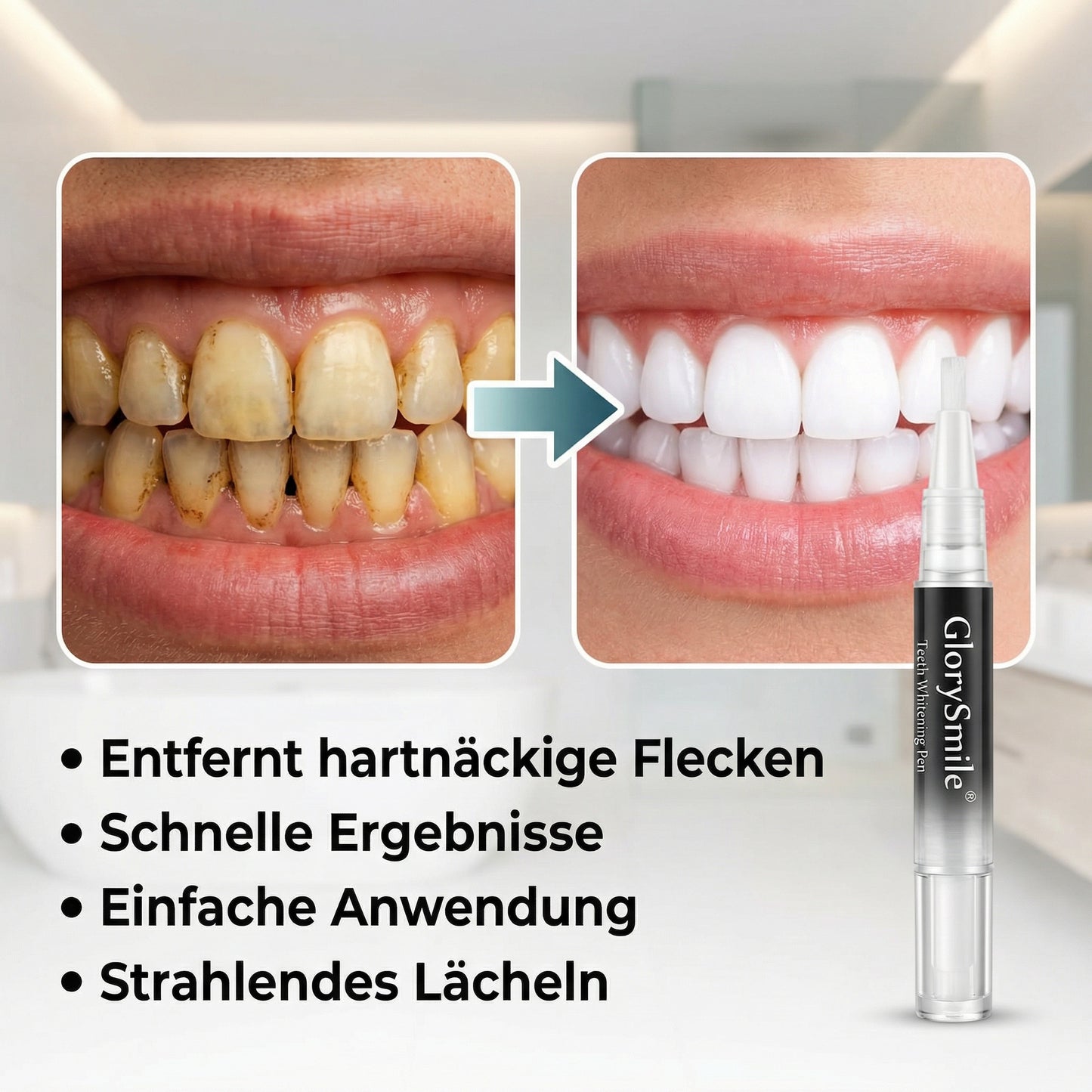 GlorySmile - Weisse Zähne, Schönes Lächeln