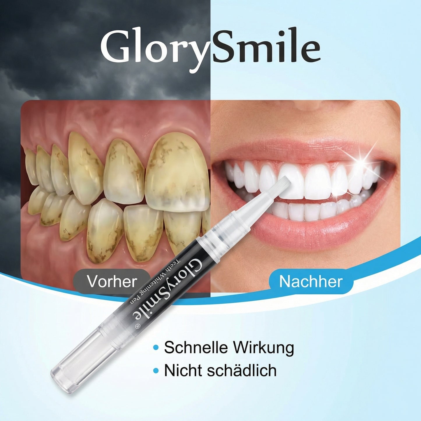 GlorySmile - Weisse Zähne, Schönes Lächeln