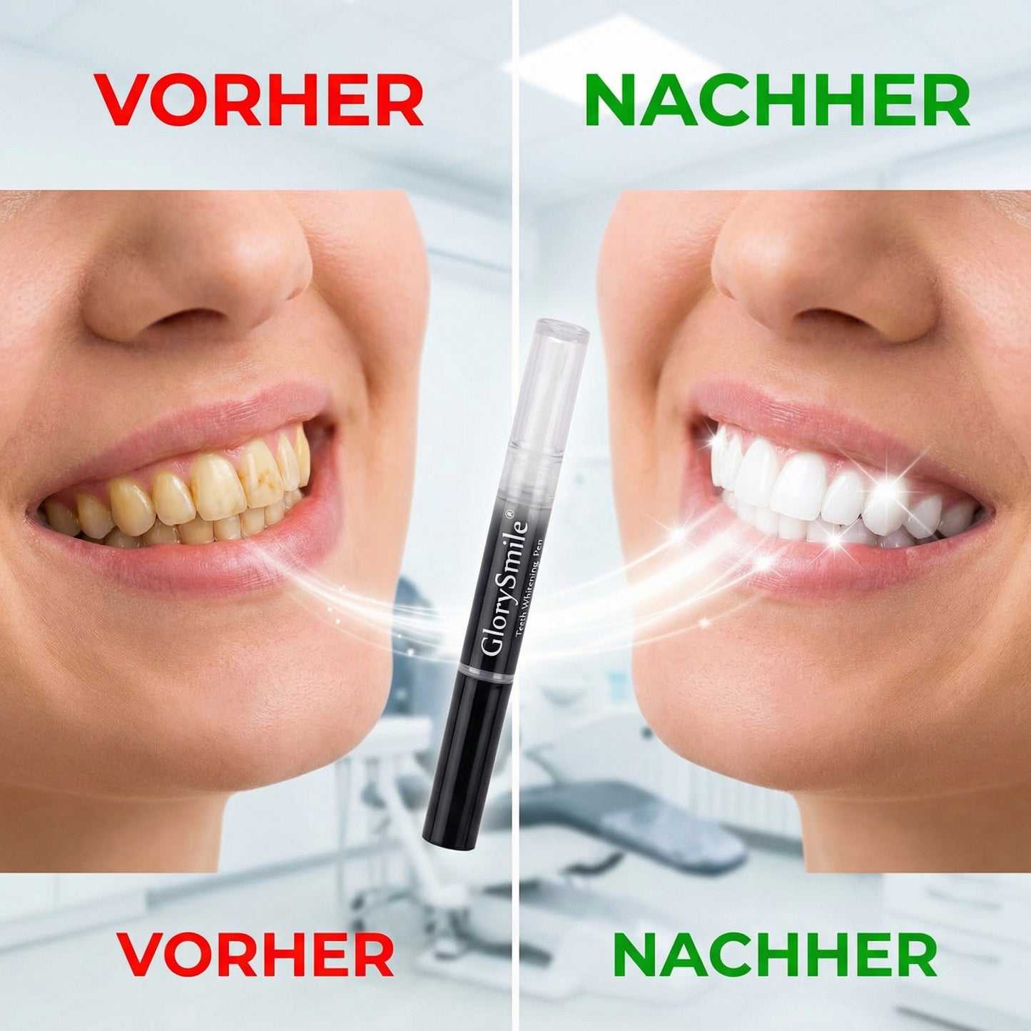 GlorySmile - Weisse Zähne, Schönes Lächeln